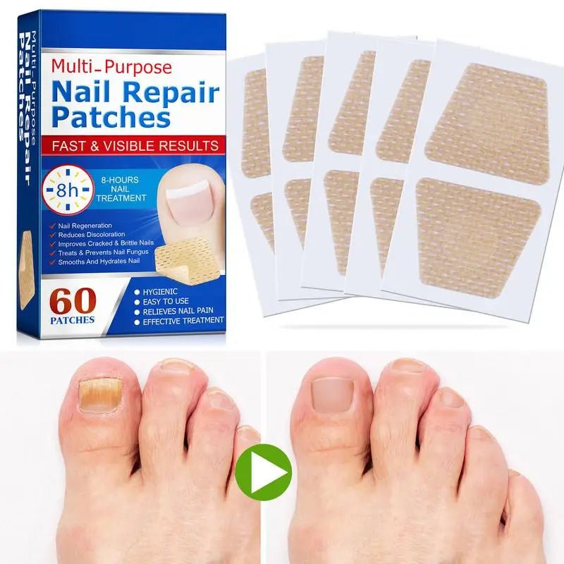 60pcs/set Nail Repair Patches Non Irritating Nail Ingrowning Toenail Corrector Stickers Helps With Cracked Nails - Paola Center